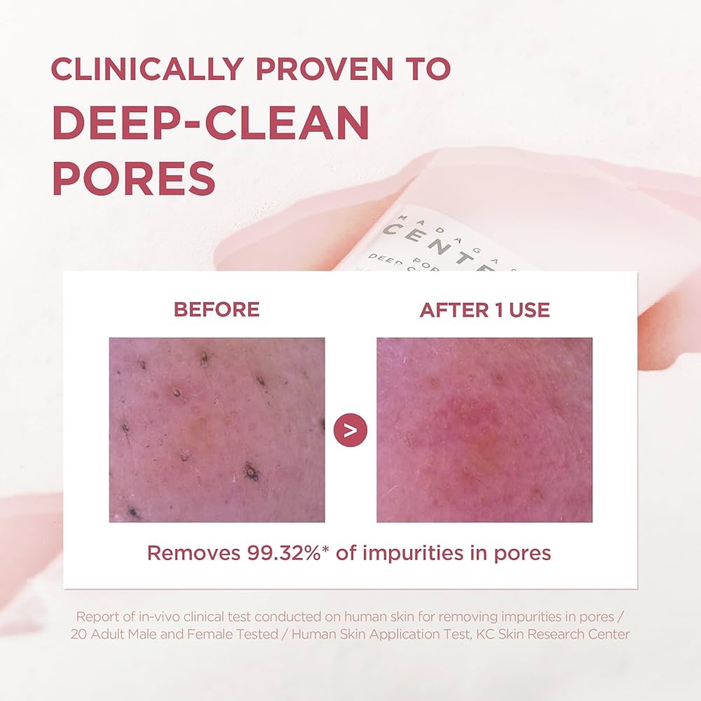 SKIN1004 Madagascar Centella Poremizing Deep Cleansing Foam 125ml, - Image 3