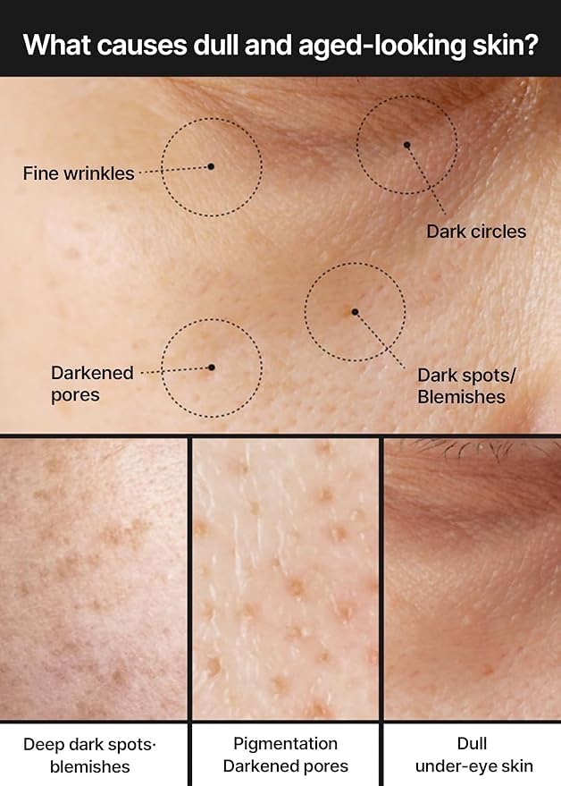 celimax Pore + Dark Spot Brightening Cream - Image 4