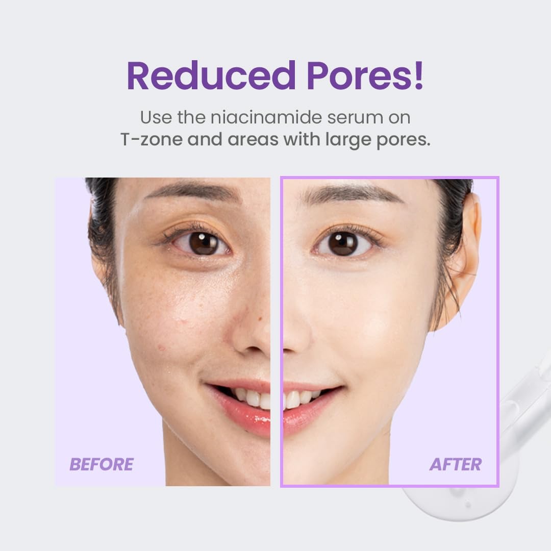 TIRTIR Niacinamide 20% Serum 30ml - Image 4
