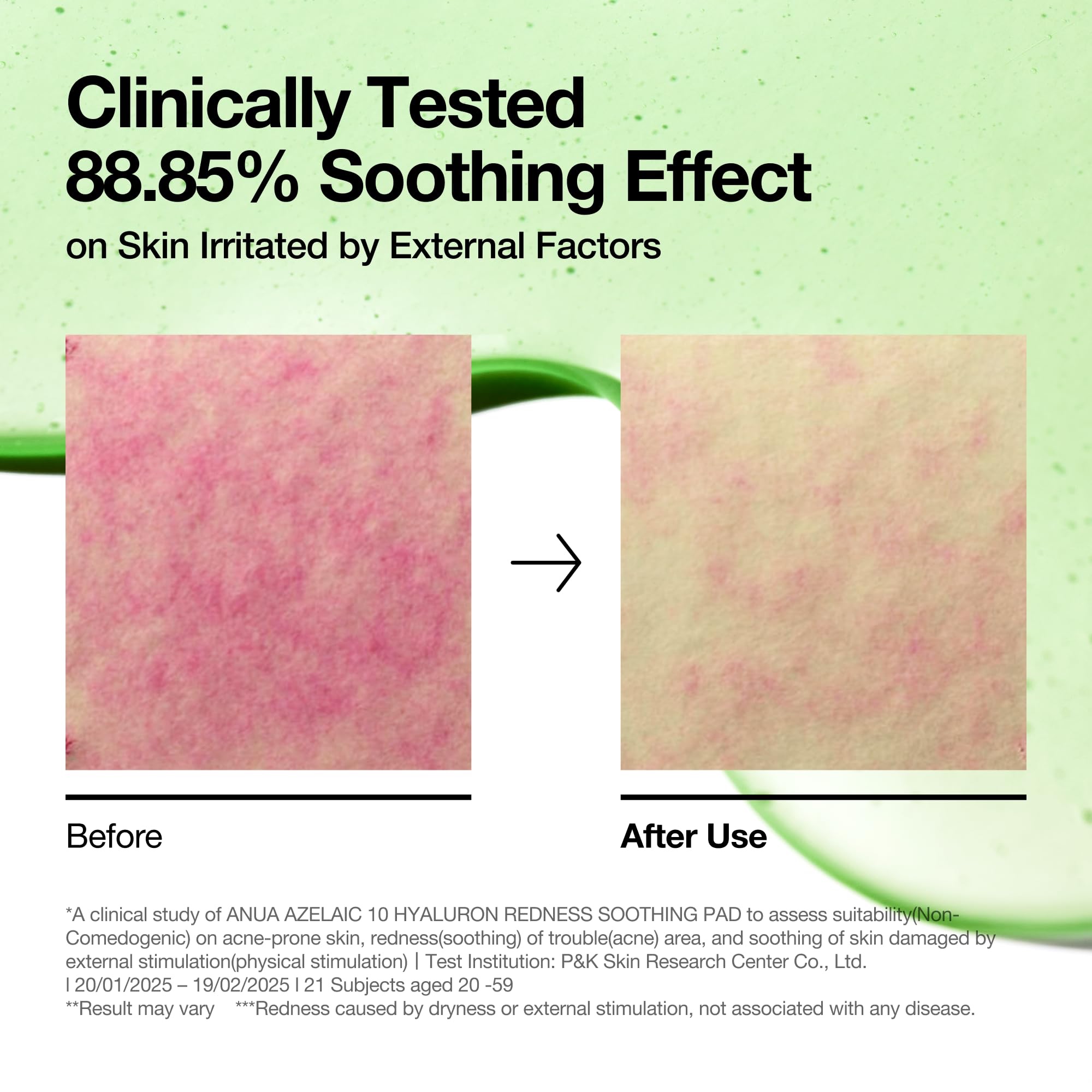 Anua Azelaic 10 Hyaluronic Redness Soothing Pad, Troubled & Spot Care with Korean Toner Pads, Quick & Easy Stretchy Face Mask with Azelaic Acid, Hyaluronic Acid, Korean Skin Care (90 Pads) - Image 6