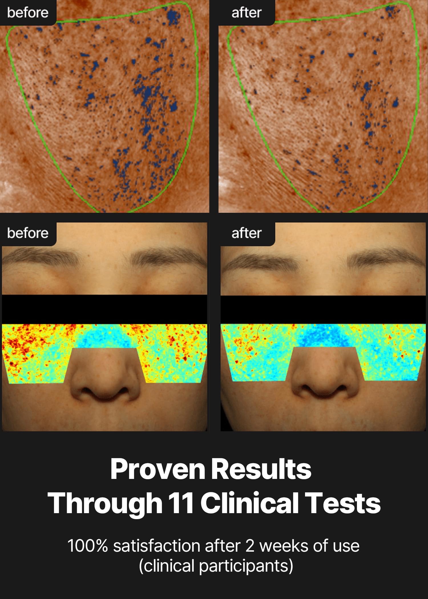 celimax Pore + Dark Spot Brightening Cream - Image 6